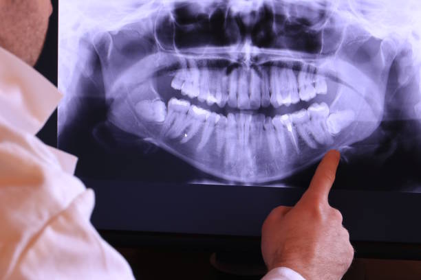 Best Emergency Dentist for Lost Fillings or Crowns in Heyburn, ID