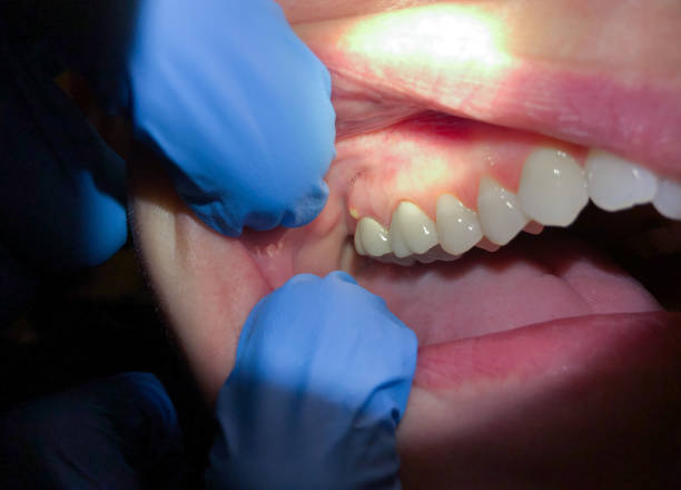 Best Pediatric Emergency Dentist in Heyburn, ID